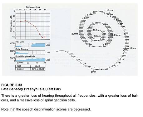 Pathologies de l'Oreille, Volume 5 : L'Oreille Interne