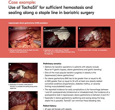 Utilisation de TachoSil® en Chirurgie Bariatrique pour une Hémostase et une Etanchéité Suffisantes lors de la Gastrectomie Laparoscopique