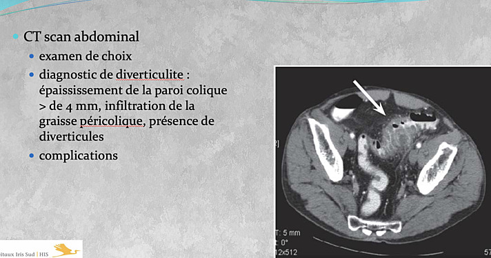 Abdomen aigu / Focus sur l’aspect pratique
