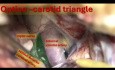 Trianglo Ophtalmo-Carotidien
