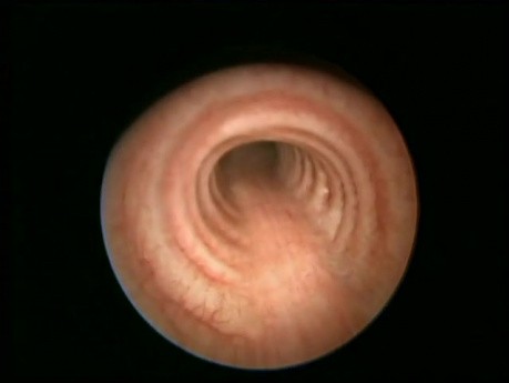 Larynx, Trachée et Bronches de l'Adulte – Anatomie Normale