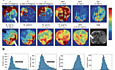 Carcinome hépatocellulaire