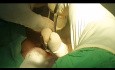 Le drainage chirurgical péricardique sous-xiphoïdien pour tamponnade