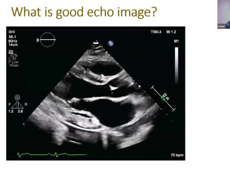 Qu'est Ce Qu'une Echographie de Bonne Qualité? 