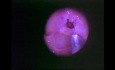 Chirurgie fonctionnelle endoscopique des sinus - Anatomie - partie 5/5