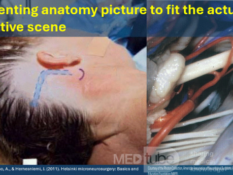 Image pour Réorienter l'Anatomie
