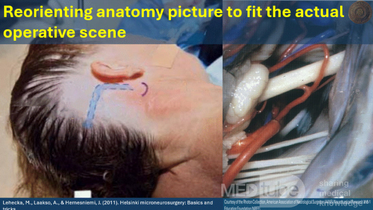Image pour Réorienter l'Anatomie