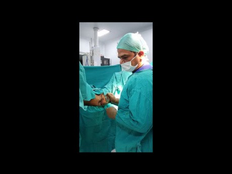 Le rôle d'une colostomie dans le traitement des fistules anales