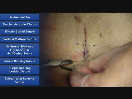 Point en cadre, figure de 8, point en U - les techniques de la suture