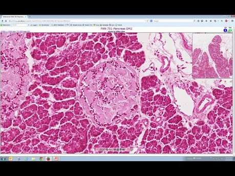 Les échantillons et  la microscopie - Le diabète