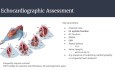 Le Don de Vie – Le Don d’Organes au Canada et l’Evaluation Echocardiographique des Cœurs de Donneurs