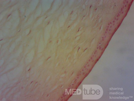 Cornée, épithélium stratifié 