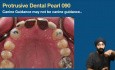Basics Of Occlusion