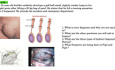 Discussion de Cas Cliniques en Chirurgie Générale - Modules 1 à 9