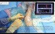 L'acces Veineux en Toute Simplicite (7)
