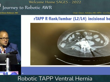 Hernie Ventrale Robotique TAPP