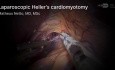 Cardiomyotomie de Heller Laparoscopique