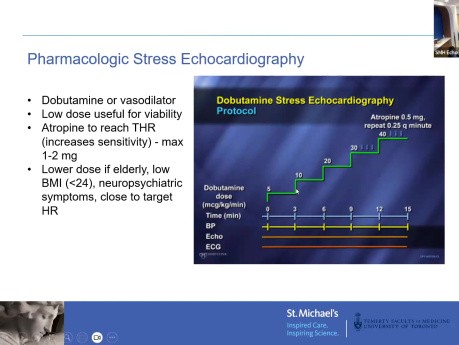 Échocardiographie de Stress et Evaluation de la Coronaropathie : un Aperçu