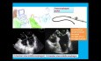 Quiz d'échocardiographie transœsophagienne et une introduction aux vues en ETT (orteil)