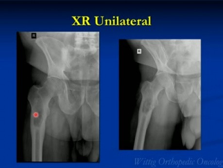 Cours d'oncologie orthopédique - Cas inconnus du test, partie B (cas 11 à 20) - Conférence 12