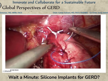 Quoi? Des Implants en Silicone pour Traiter le Reflux Gastro-Oesophagien?