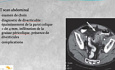 Abdomen aigu / Focus sur l’aspect pratique