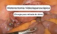 Hystérectomie Totale Laparoscopique [Vidéo Courte]