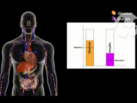 Contrôle du taux de glucose