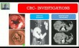 Cancer du côlon - hémorragie gastro-intestinale basse