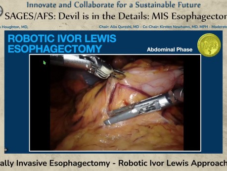 Œsophagectomie Mini-Invasive - Approche Robotique d'Ivor Lewis (OMI)
