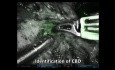 Résection Robotique de la Tête du Pancréas avec Préservation des Voies Biliaires et Neurectomie Splanchnique Guidée par Fluorescence pour Pancréatite Chronique