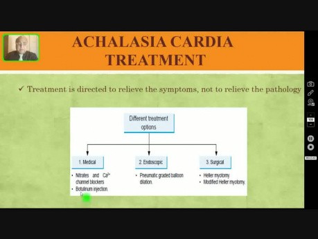 Achalasie - dysphagie