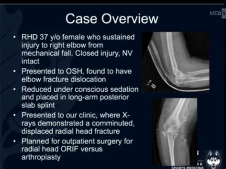 OrthoProcédure - Arthroplastie de la Tête Radiale