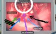 Medial Clinoidal Meningioma