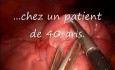 Diverticule de Meckel invaginé vue pendant la cœlioscopie