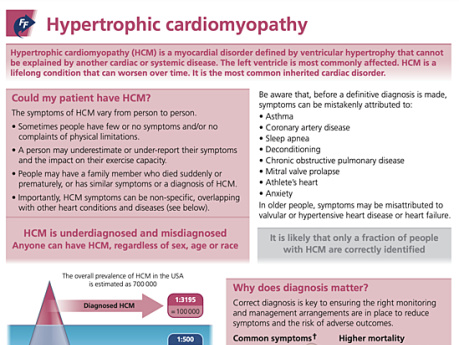 Cardiomyopathie hypertrophique