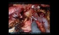 Whipple Robotique (AHPBA 2019)