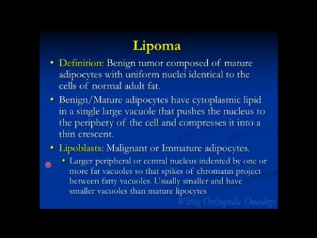 Cours d'oncologie et de pathologie orthopédique - Tumeurs bénignes des tissus mous (lipome, etc.) - Conférence 9