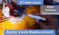 Valve Aortique de 31mm