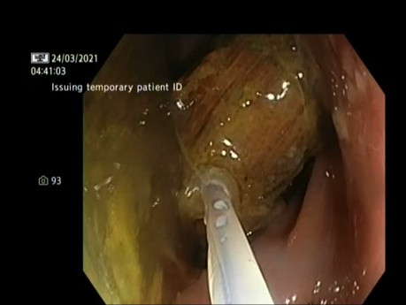 Long jouet sexuel en bois glissé dans le rectum