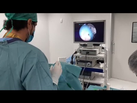 Configuration de la Salle d'Opération pour la Chirurgie Endoscopique de l'Oreille