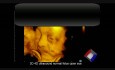 Échographie normale 3D-4D du fœtus qui ouvre les yeux