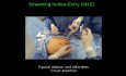 Accidents lors de l'Abord Abdominal: Stratégie Préventive Standardisée pour Eviter les Risques et les Accidents