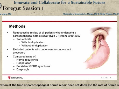 La Fundoplicature Concomitante à la Réparation d'une Hernie Para-œsophagienne ne Diminue pas le Taux de Récidive de la Hernie.