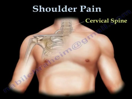 Douleur à l'épaule - anatomie et examen