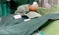 Angiographie Coronaire par Accès Radial