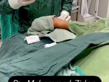 Angiographie Coronaire par Accès Radial