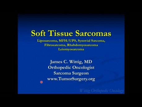 Cours d'oncologie orthopédique - Sarcome des tissus mous (liposarcome, MFH, etc.) - Conférence 10