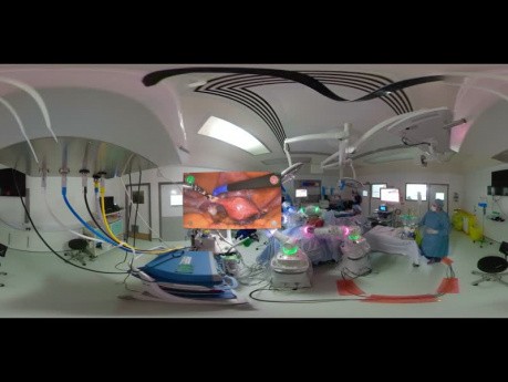 Hystérectomie à 360° avec Versius au Milton Keynes University Hospital