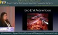 Anastomose Gastro-Intestinale : Conseils et Astuces pour Eviter et Gérer les Fuites Anastomotiques